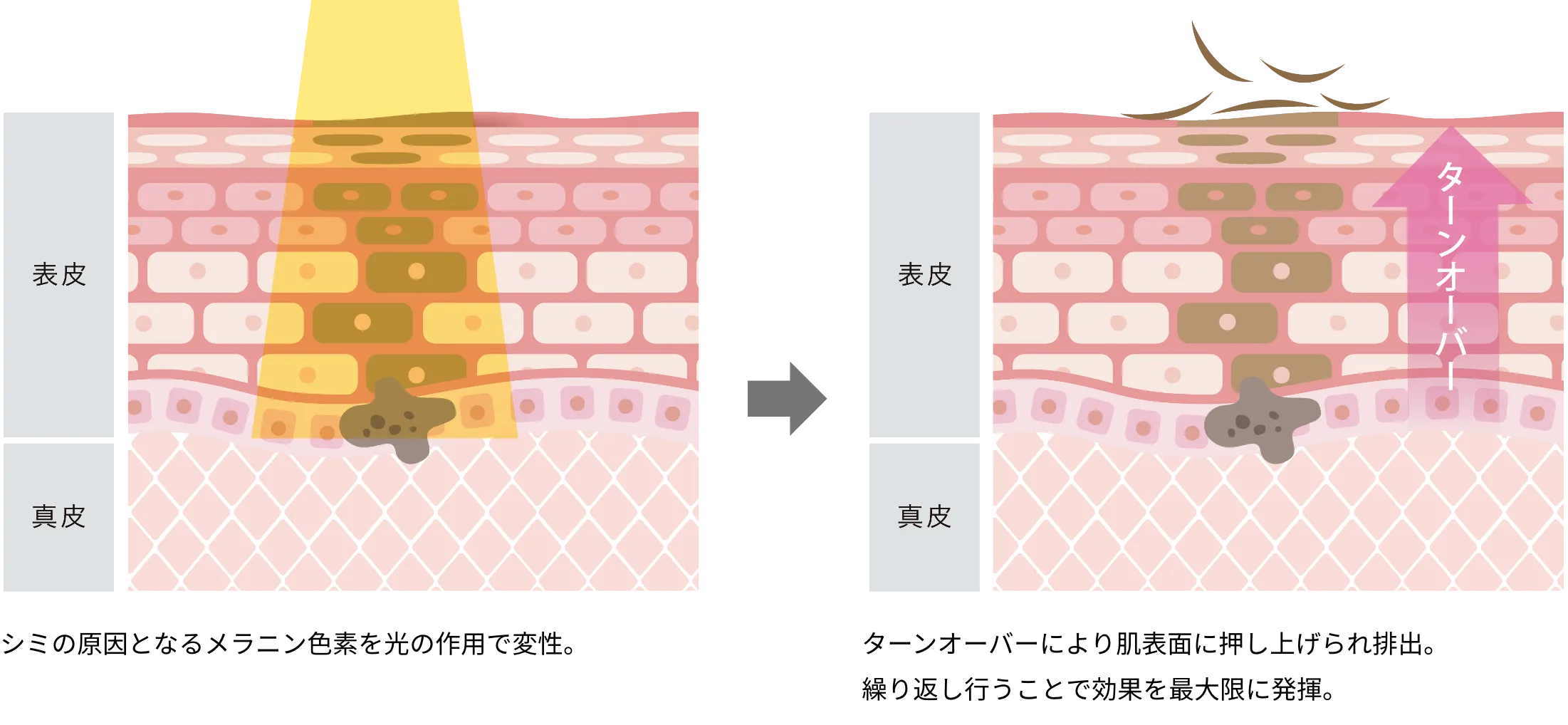 治療の流れ