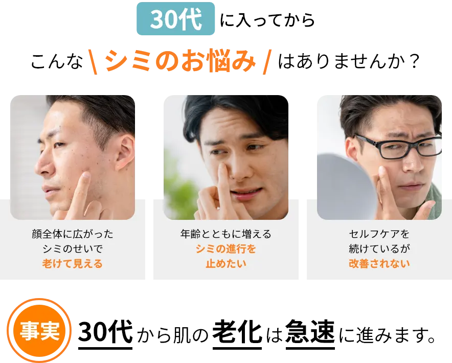 こんなシミのお悩みありませんか？