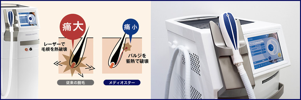 ミラドライの治療内容