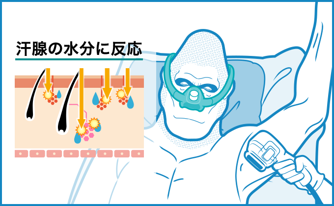 汗腺の水分に反応