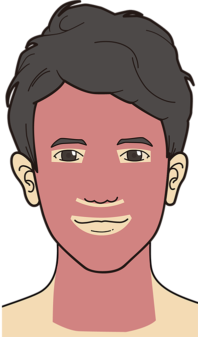 ほくろ・イボ治療の対応範囲