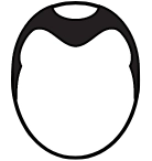 AGA治療